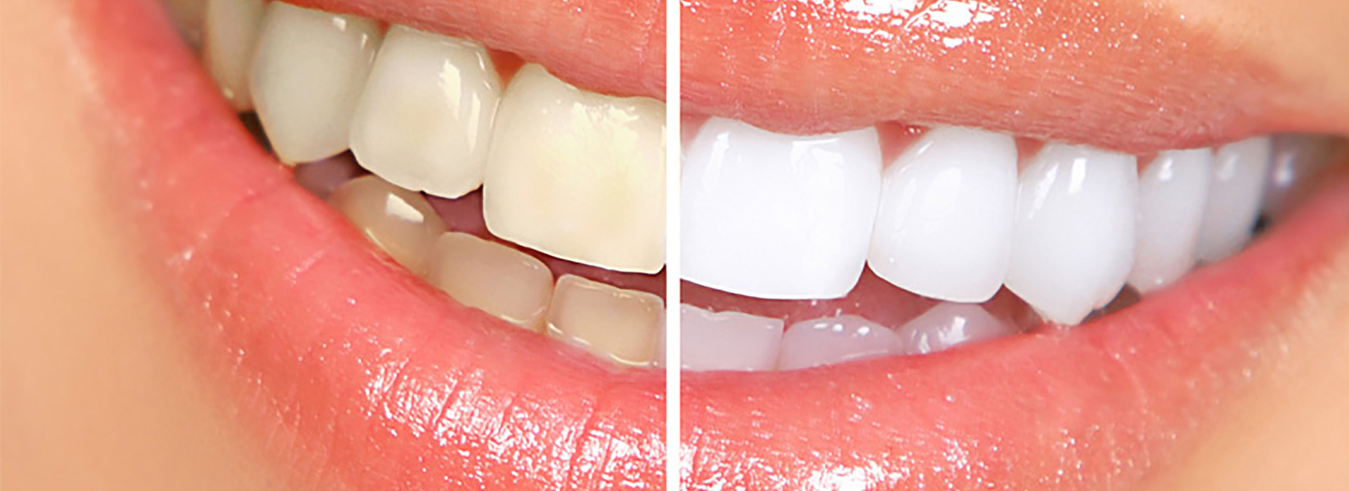 Dental hospital in Dilsukhnagar